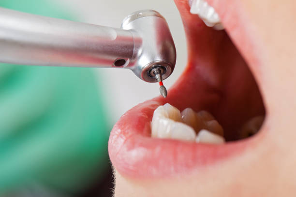 Best Emergency Dentist for Knocked-Out Tooth in Piketon, OH